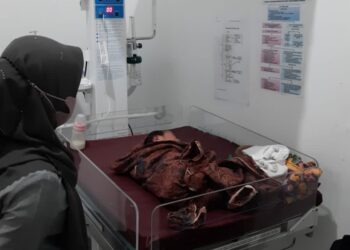 Tega, Bayi Berumur 2 Hari Dibuang di Teras Rumah Warga Agam