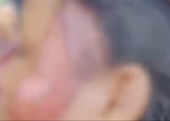 Ibu Kandung di Padang Pariaman Aniaya Anaknya Sendiri, Korban Mengalami Luka di Sekujur Tubuh