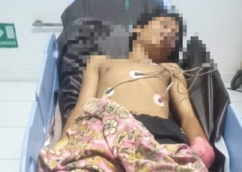 Seorang Remaja Tangannya Putus Akibat Tawuran di Jembatan Malindo Lubuk Begalung, Pelaku Ditangkap